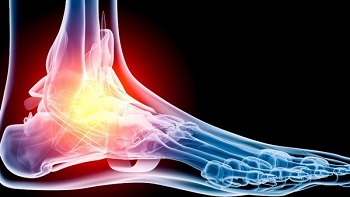 foot_and_ankle osteoarthritis diagnosis