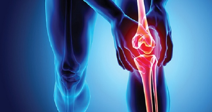 leg-up in diagnosing knee osteoarthritis